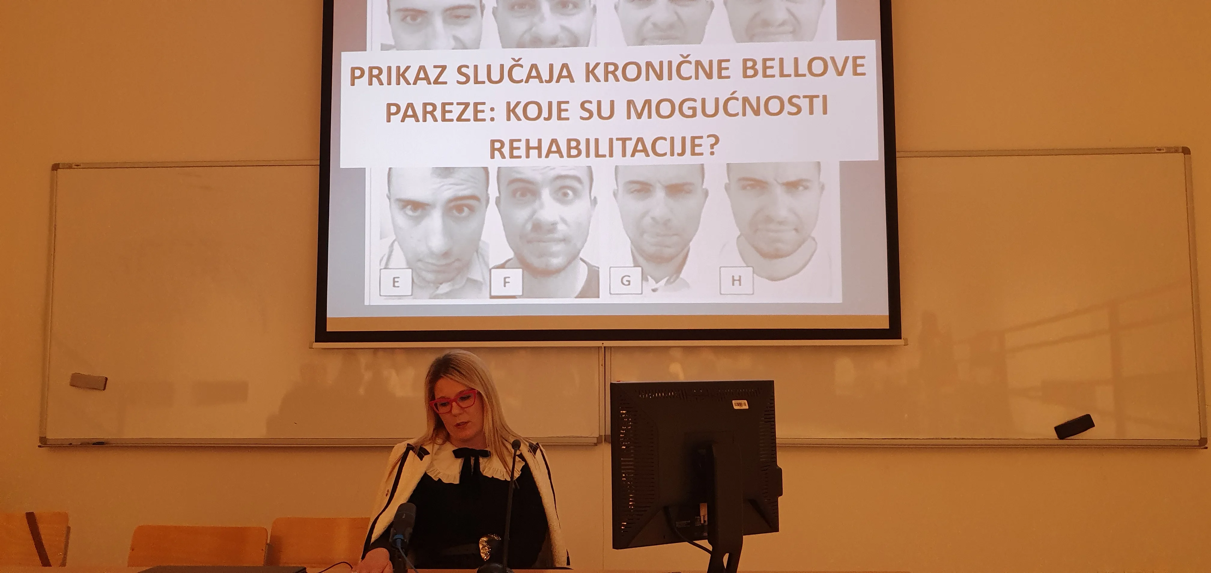 Predavanje o Bellovoj parezi na Fakultetu zdravstvenih studija